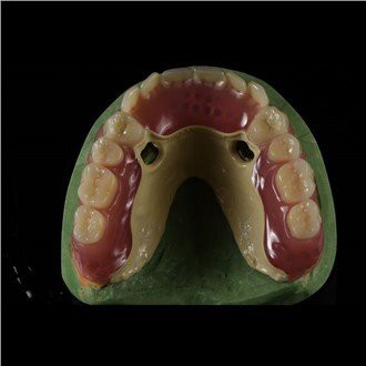 Peek Framework protese