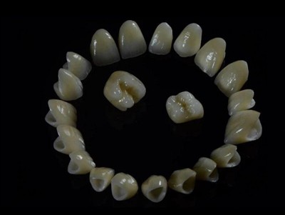 Dental Lab Zirconia Crowns: Kvalitet, proces og hvad man skal kigge efter i e...