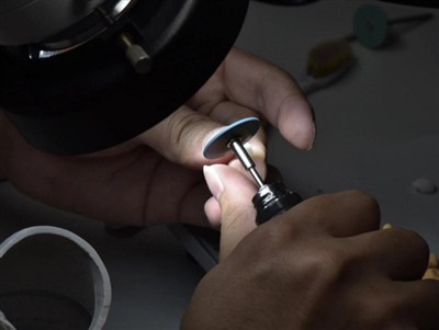 Hvor længe holder PFM-kroner? Gennemsnitlig levetid, faktorer og plejetips