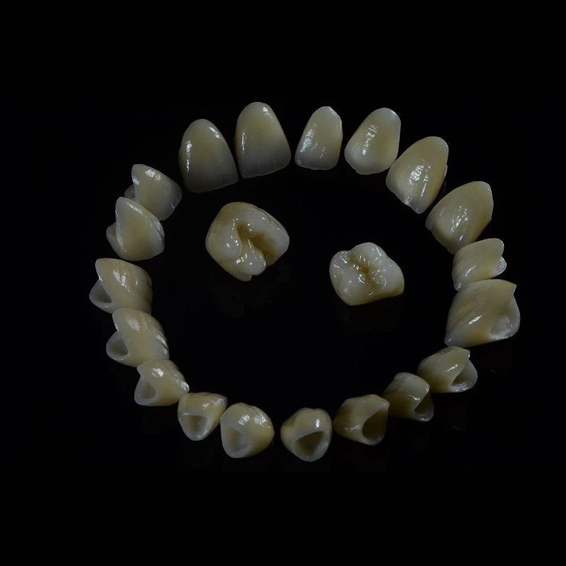 Layered Zirconia Crown